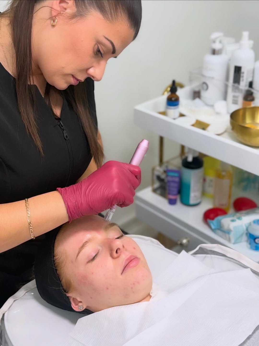 Katie performing microneedling treatment at TLC The Luxury Clinic, Maidstone