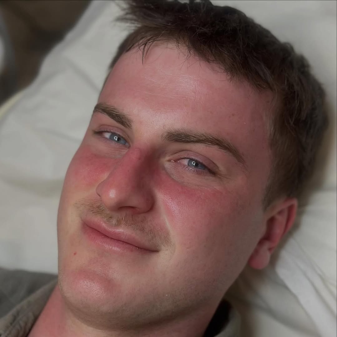 Before and after skin treatment at TLC The Luxury Clinic, Maidstone