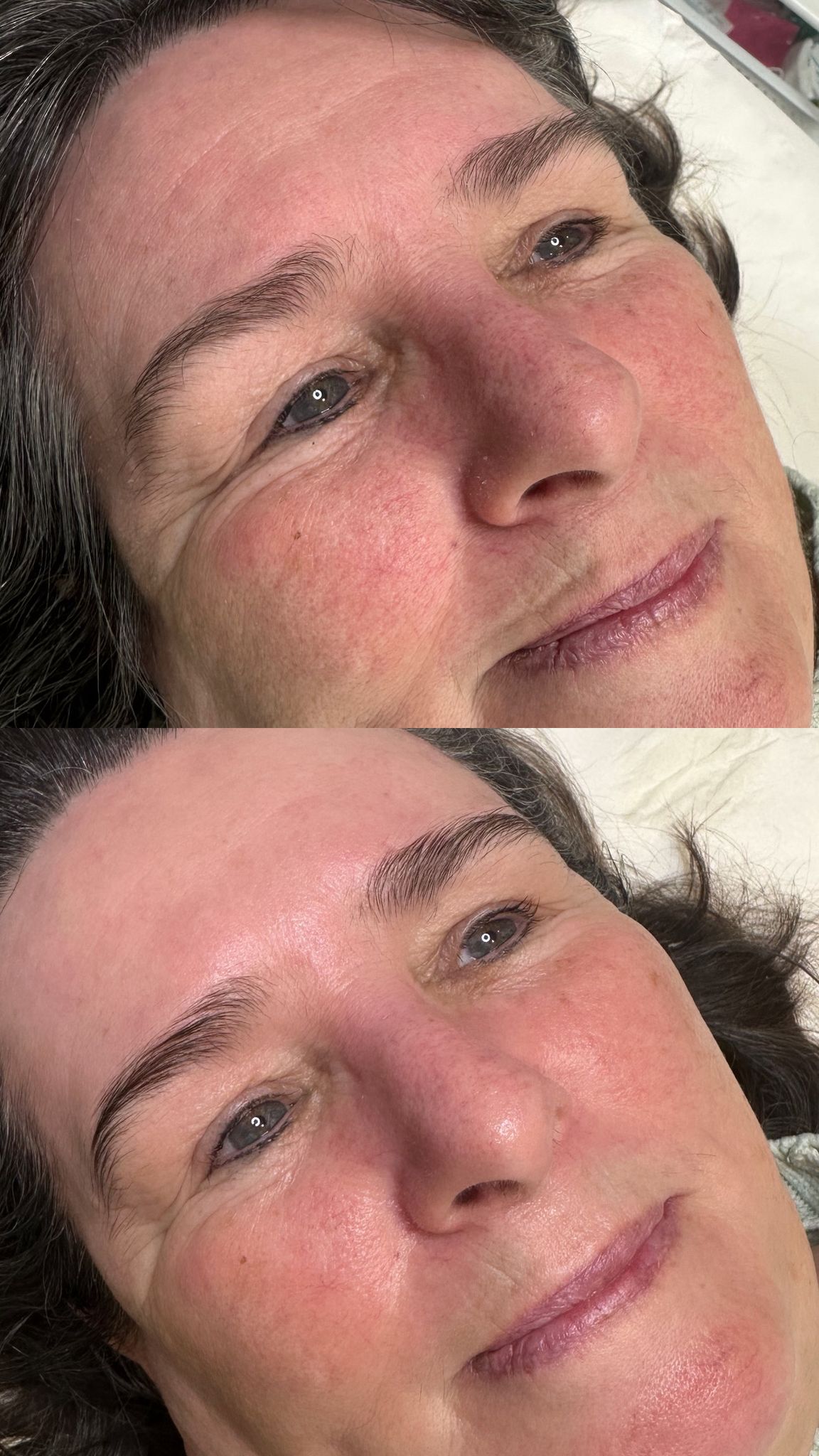 Before and after TLC Ultimate Facial Package at TLC Maidstone